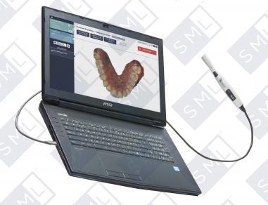 Condor DIgital Scanner