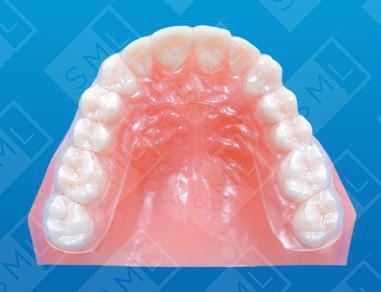 Retainer