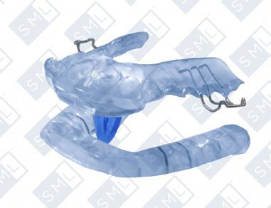 Dental Sleep Appliances