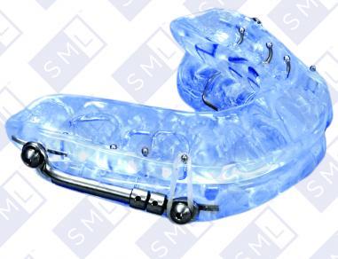 Help with Sleep Apnea