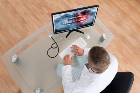 Digital Scanning Intra-Oral Scanner 