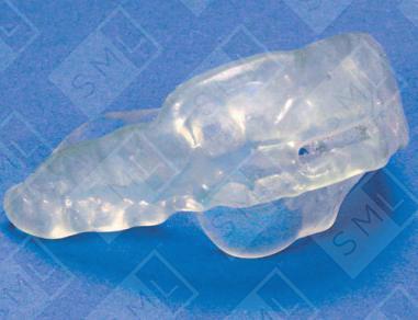 SnoreFree™ - Anti Snoring Appliance image 2