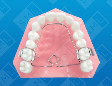 3D Multi-Action Palatal Appliance
image 1