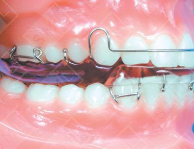 Mahony Twin Block image 1