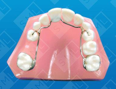 Fixed Banded Temporary Anterior Bridge U/L image 1