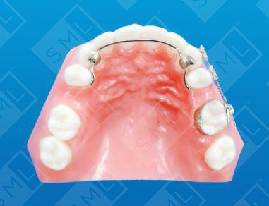 Fixed Sectional Distalizer U/L