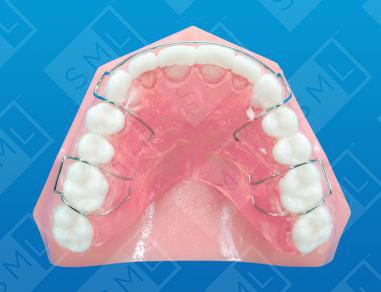 Maxillary Final Retainer U, Arch Development, Orthodontic Lab Appliance ...