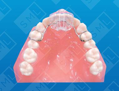 Maxillary Anterior Night Splint U image 1