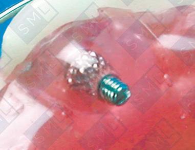 Micro-Screw Replacements image 1