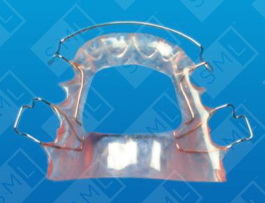 Open Palate Retainer U