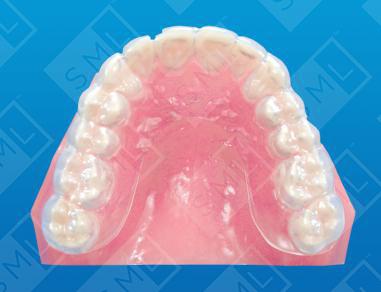 Protective Splint U/L