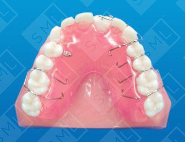 Removable Forced Eruption Appliance
image 1