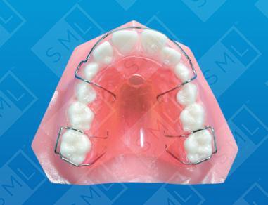 Removable Tongue Positioner , Hawley Retainer 5mm hole, Lingual to the ...