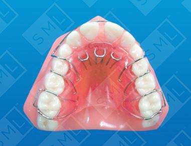 Removable Tongue Loops U image 1