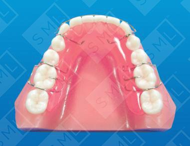 Simple Mandibular Retainer L