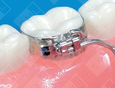 Blue Grass Dental Appliance