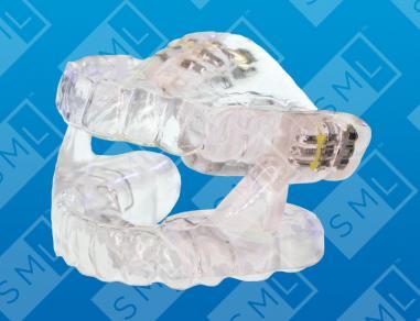 Sleep Dental Appliances