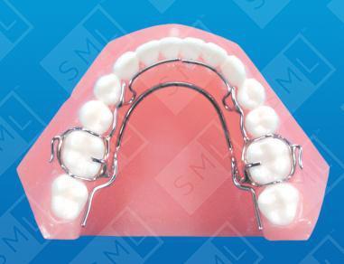 Basic Mandibular Crozat w/ Lingual Springs