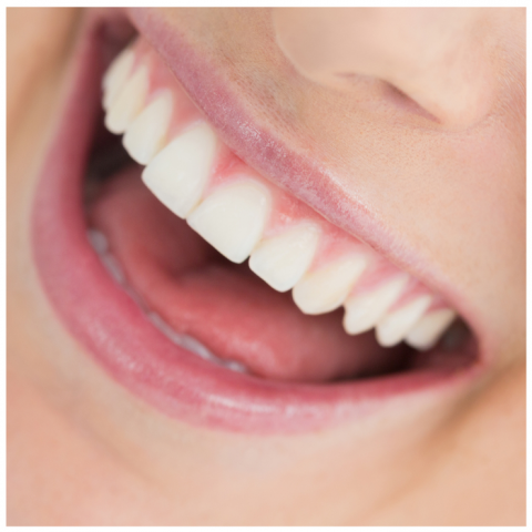 Benefits of Cosmetic Dentistry