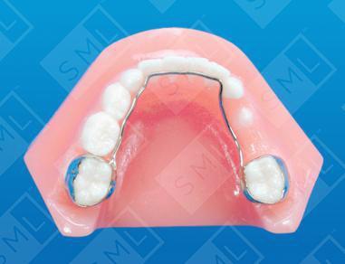 Space Maintainers for your Teeth