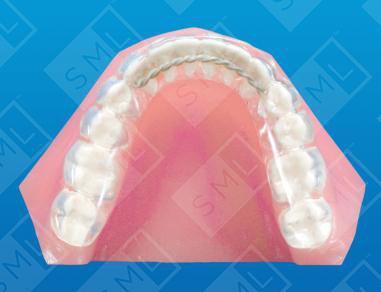 Even Happy Events Can Leave You Grinding Your Teeth 