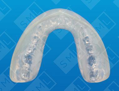 Positioner after braces