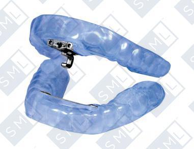 Are You Choking in Your Sleep?  Tap 3 Elite Sleep Appliance
