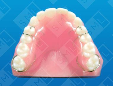 Interim Dental Appliances
