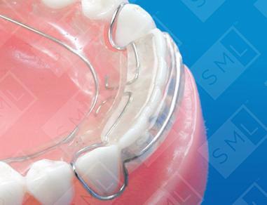 Hawley Retainers