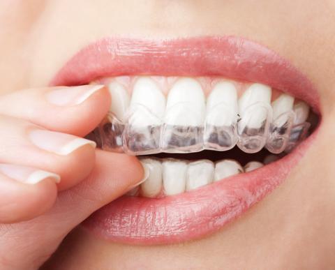 Orthodontic Appliances